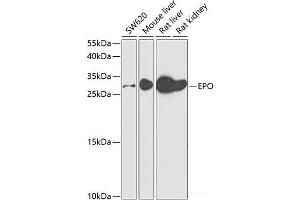 Western blot analysis of extracts of various cell lines using EPO Polyclonal Antibody at dilution of 1:500. (EPO anticorps)