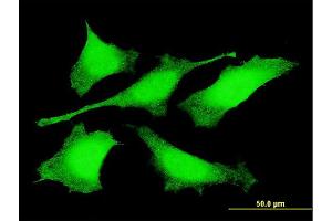 Immunofluorescence of monoclonal antibody to PRDM4 on HeLa cell.
