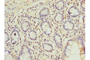 Immunohistochemistry of paraffin-embedded human small intestine tissue using ABIN7174997 at dilution of 1:100 (C9orf16 anticorps  (AA 1-83))