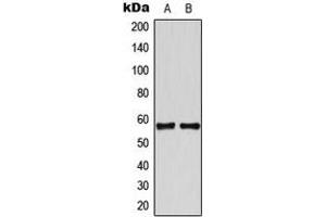 Western blot analysis of TBX22 expression in HeLa (A), Jurkat (B) whole cell lysates. (T-Box 22 anticorps  (N-Term))