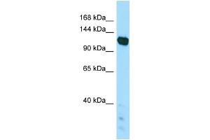 WB Suggested Anti-PAPLN Antibody Titration: 1. (PAPLN anticorps  (C-Term))