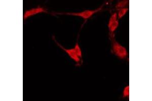 anti-Epoxide Hydrolase 4 (EPHX4) (Internal Region) antibody