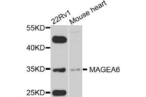 Western blot analysis of extracts of various cell lines, using MAGEA6 antibody. (MAGEA6 anticorps)