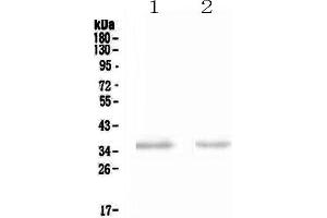 Western blot analysis of NCR1 using anti-NCR1 antibody . (NCR1 anticorps  (AA 22-258))