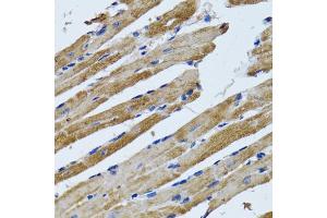 Immunohistochemistry of paraffin-embedded rat heart using ATP5B antibody (ABIN2561285) at dilution of 1:100 (40x lens). (ATP5B anticorps)