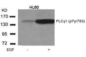 Image no. 1 for anti-phospholipase C, gamma 1 (PLCG1) (pTyr783) antibody (ABIN196792) (Phospholipase C gamma 1 anticorps  (pTyr783))