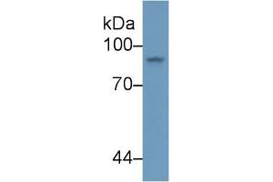 Detection of STAT4 in Human K562 cell lysate using Polyclonal Antibody to Signal Transducer And Activator Of Transcription 4 (STAT4)