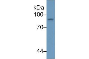 Detection of STAT4 in Human K562 cell lysate using Polyclonal Antibody to Signal Transducer And Activator Of Transcription 4 (STAT4) (STAT4 anticorps  (AA 505-737))