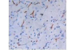Detection of ALB in Mouse Brain Tissue using Polyclonal Antibody to Albumin (ALB)