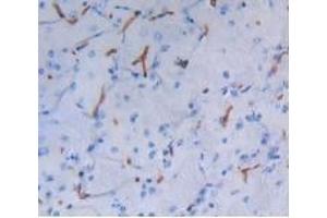 Detection of ALB in Mouse Brain Tissue using Polyclonal Antibody to Albumin (ALB) (Albumin anticorps)
