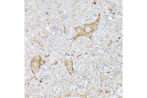 Immunohistochemistry of paraffin-embedded mouse spinal cord using TBCA antibody (ABIN6131384, ABIN6148884, ABIN6148885 and ABIN6216894) at dilution of 1:100 (40x lens). (TBCA anticorps  (AA 1-108))