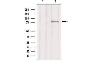 Western blot analysis of extracts from Hepg2, using RHG25 Antibody. (ARHGAP25 anticorps  (Internal Region))