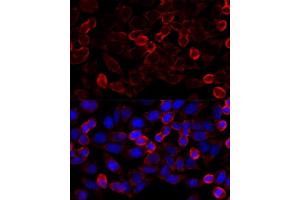 Immunofluorescence analysis of HeLa cells using HD antibody (ABIN6128054, ABIN6141681, ABIN6141684 and ABIN6215131) at dilution of 1:100 (40x lens).