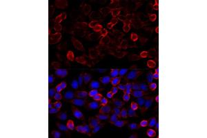Immunofluorescence analysis of HeLa cells using HD antibody (ABIN6128054, ABIN6141681, ABIN6141684 and ABIN6215131) at dilution of 1:100 (40x lens). (HDAC6 anticorps  (AA 836-1104))
