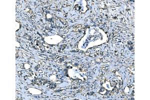 IHC analysis of SPG3A/ATL1 using anti-SPG3A/ATL1 antibody (ABIN7603095).