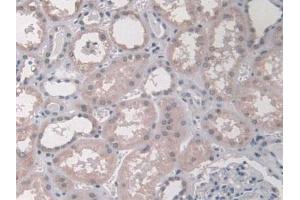 Detection of KLC1 in Human Kidney Tissue using Polyclonal Antibody to Kinesin Light Chain 1 (KLC1)