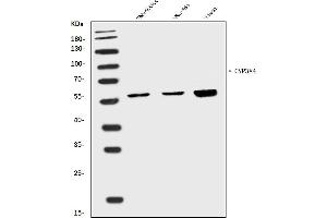 Western blot analysis of Cytochrome P450 3A4/CYP3A4 using anti-Cytochrome P450 3A4/CYP3A4 antibody (ABIN7601737).