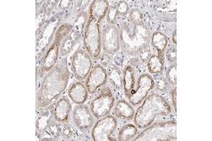 Immunohistochemical staining of human kidney with ZYG11B polyclonal antibody  shows cytoplasmic positivity in cells of tubules.
