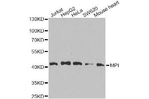 Western blot analysis of extracts of various cell lines, using MPI antibody. (MPI anticorps  (AA 1-423))