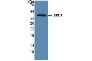 Detection of Recombinant TBK1, Human using Polyclonal Antibody to TANK Binding Kinase 1 (TBK1) (TBK1 anticorps  (AA 9-310))
