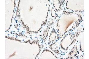 Immunohistochemical staining of paraffin-embedded Human Kidney tissue using anti-USP5 mouse monoclonal antibody. (USP5 anticorps)