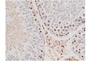 ABIN6267502 at 1/200 staining Rat testis tissue sections by IHC-P.