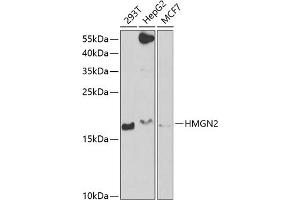 Western blot analysis of extracts of various cell lines, using HMGN2 antibody  at 1:1000 dilution.