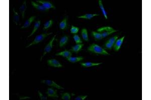 Immunofluorescence staining of Hela Cells with ABIN7127446 at 1:50, counter-stained with DAPI. (Recombinant CYP17A1 anticorps)