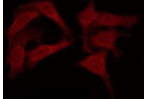 ABIN6276071 staining HuvEc by IF/ICC.