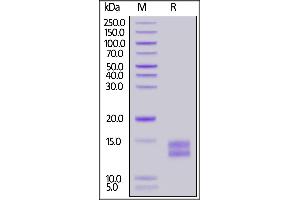 Mouse BCMA, His Tag on  under reducing (R) condition.