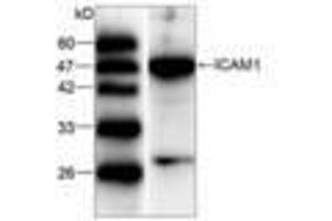 Image no. 1 for anti-Intercellular Adhesion Molecule 1 (ICAM1) (AA 301-532) antibody (ABIN791496) (ICAM1 anticorps  (AA 301-532))