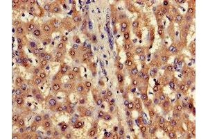 Immunohistochemistry of paraffin-embedded human liver tissue using ABIN7153223 at dilution of 1:100 (FUOM anticorps  (AA 1-134))