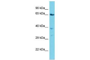 Host: Rabbit  Target Name: Vps45  Sample Tissue: Mouse Lung lysates  Antibody Dilution: 1. (VPS45 anticorps  (C-Term))