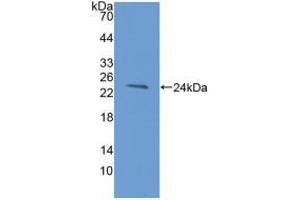 Western blot analysis of recombinant Human HAVCR2. (TIM3 anticorps  (AA 22-202))