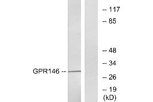 Western blot analysis of extracts from LOVO cells, using GPR146 antibody.