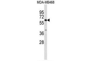 Western blot analysis of CES7 Antibody (Center) in MDA-MB468 cell line lysates (35µg/lane). (CES5A anticorps  (Middle Region))