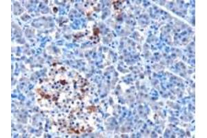 Immunohistochemistry (IHC) image for anti-Interferon Induced with Helicase C Domain 1 (IFIH1) (N-Term) antibody (ABIN2465934) (IFIH1 anticorps  (N-Term))