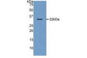Detection of Recombinant LRP5, Human using Polyclonal Antibody to Low Density Lipoprotein Receptor Related Protein 5 (LRP5) (LRP5 anticorps  (AA 769-1016))
