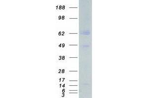 Validation with Western Blot