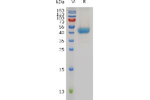 Human C Protein, hFc Tag on SDS-PAGE under reducing condition.