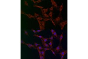 Immunofluorescence analysis of C6 cells using GOT2 antibody (ABIN6131312, ABIN6141285, ABIN6141286 and ABIN6222651) at dilution of 1:100 (40x lens).