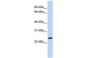 Image no. 1 for anti-MAX-Like Protein X (MLX) (AA 180-229) antibody (ABIN6744265) (MLX anticorps  (AA 180-229))
