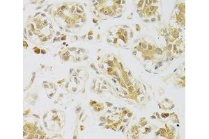 Immunohistochemistry of paraffin-embedded Human breast using Caspase-2 Polyclonal Antibody at dilution of 1:100 (40x lens). (Caspase 2 anticorps)
