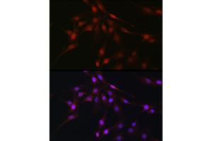 Immunofluorescence analysis of C6 cells using C9orf72 Rabbit pAb (ABIN7266391) at dilution of 1:100 (40x lens).