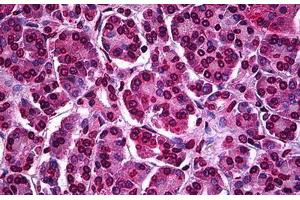 Human Pancreas: Formalin-Fixed, Paraffin-Embedded (FFPE) (ATF5 anticorps  (AA 101-200))