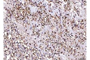 IHC analysis of Cdk2 using anti-Cdk2 antibody (ABIN7602523).