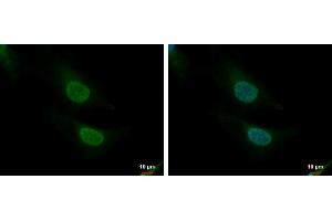 ICC/IF Image CNOT8 antibody detects CNOT8 protein at nucleus and cytoplasm by immunofluorescent analysis.