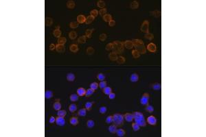 Immunofluorescence analysis of THP-1 cells using CD35/CR1 Rabbit mAb (ABIN7266477) at dilution of 1:100 (40x lens). (CD35 anticorps)
