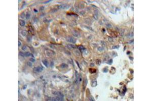 IHC-P analysis of Lung tissue, with DAB staining. (PKC theta anticorps  (AA 380-634))