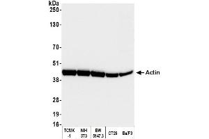 Western Blotting (WB) image for anti-Cytoskeletal Actin (CIMG_00972) (N-Term) antibody (ABIN7453904) (Cytoskeletal Actin (CIMG_00972) (N-Term) anticorps)